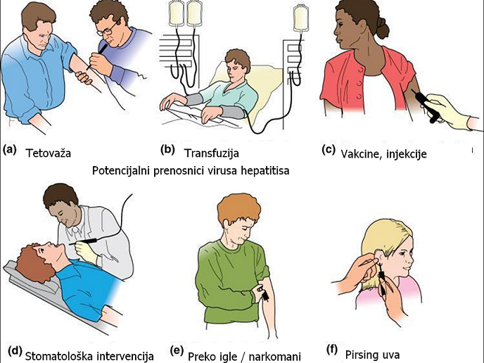 suzroci_hepatitisa